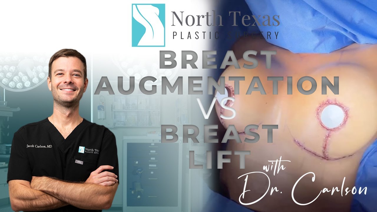 Breast Augmentation VS  Breast Lift (Mastopexy) with Dr. Carlson