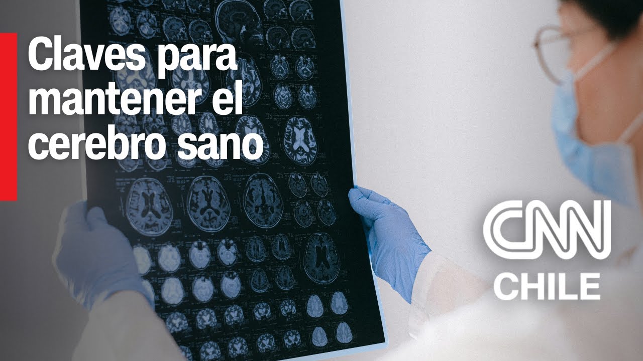 Neur&oacute;logo entrega recomendaciones: &iquest;C&oacute;mo cuidar la salud cerebral?