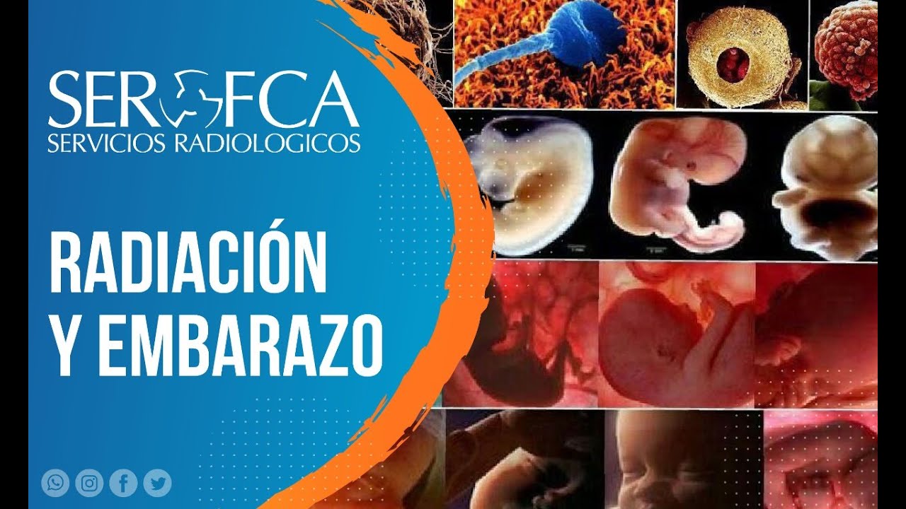 Radiación y Embarazo: Mitos y Realidades.