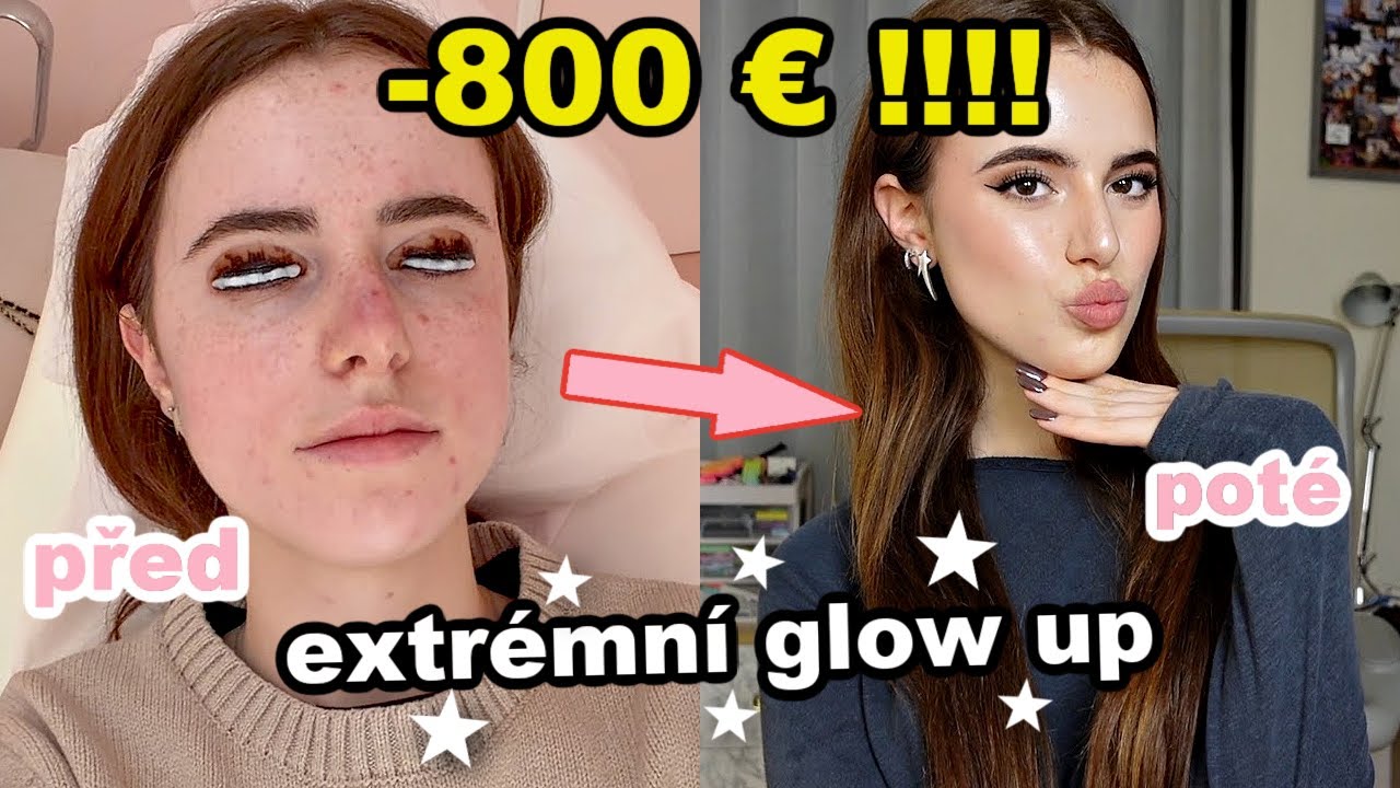 UTRATILA JSEM 800€ ZA GLOW UP... stálo to za to?