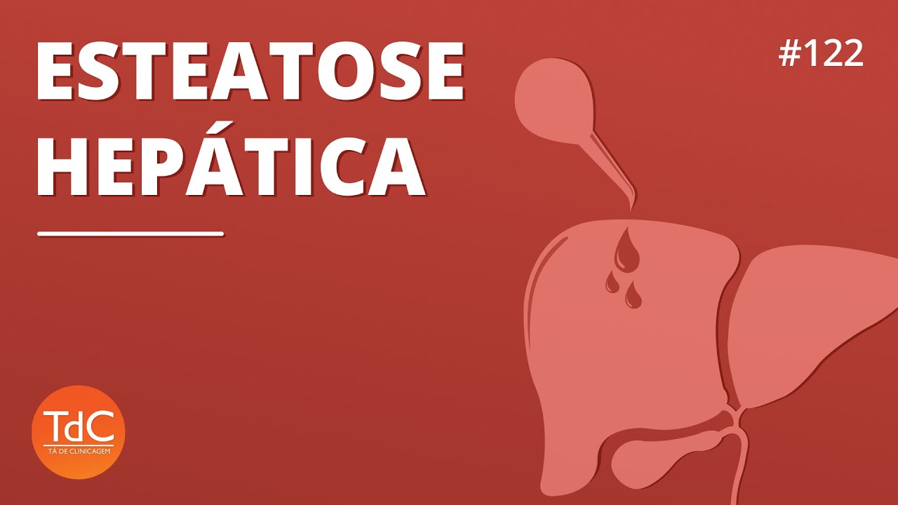 Esteatose Hep&aacute;tica: Epis&oacute;dio 122