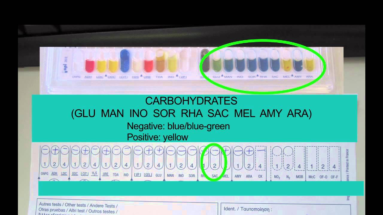 Microbiology: Using API Strips 3