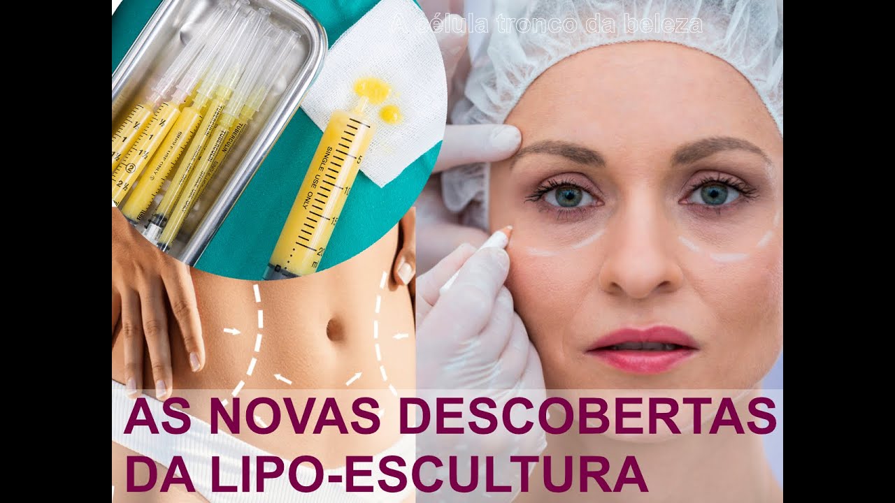 A Lipoescultura e o cuidado com o 