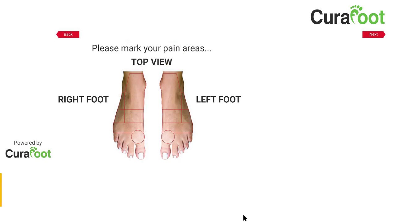 3 Steps of Foot Scanning Using AI Based Technology