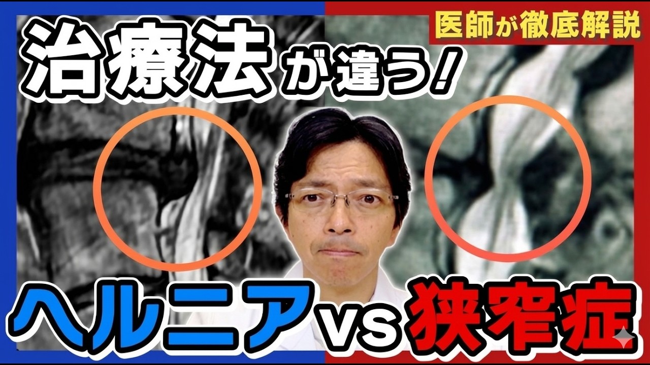 【脊椎専門医が解説】ヘルニアと狭窄症。この2つ、症状は似ていることもありますが対処法が違います。ヘルニアは自然に治る可能性がある一方、狭窄症は徐々に進行し手術が必要になることも。