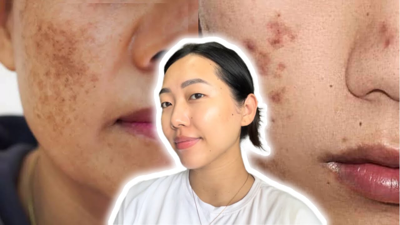 Hmai duk enkawlna serum || The DermaCo Pigmentation Corrector Serum