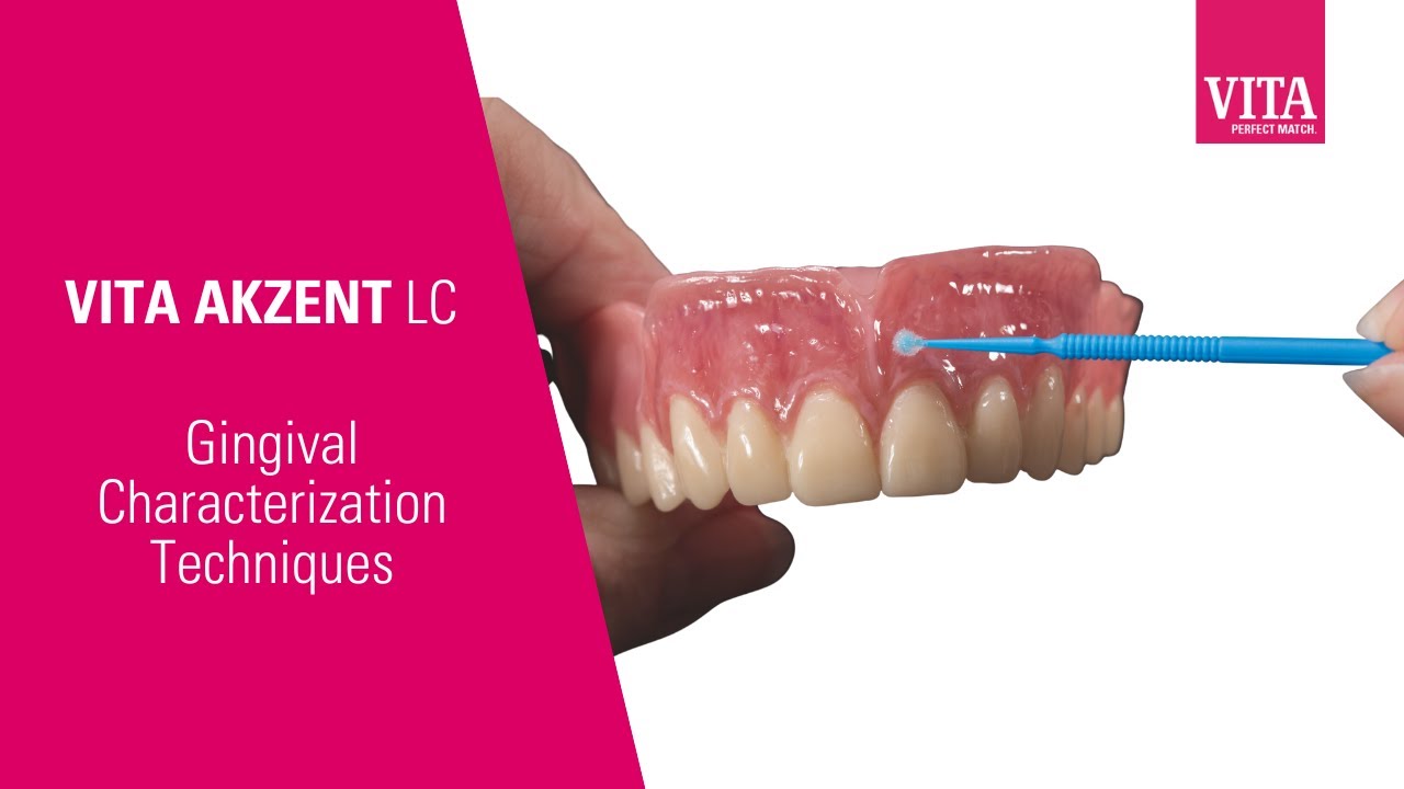 VITA AKZENT LC Gingival Characterization Techniques
