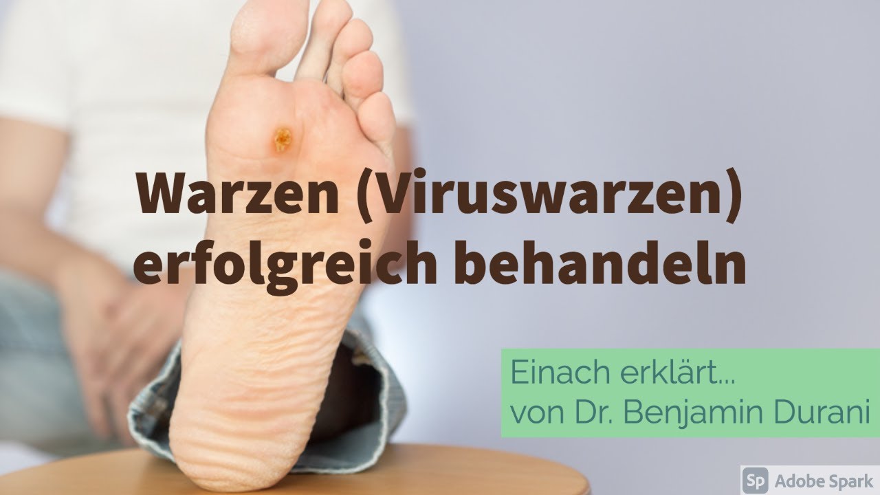Warzen (Viruswarzen) erfolgreich behandeln - Einfach erklärt von Dr. Benjamin Durani