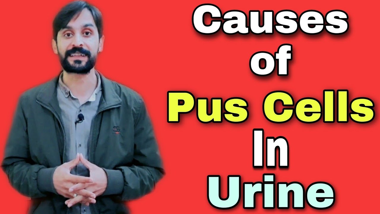 Causes of Pus Cells in Urine