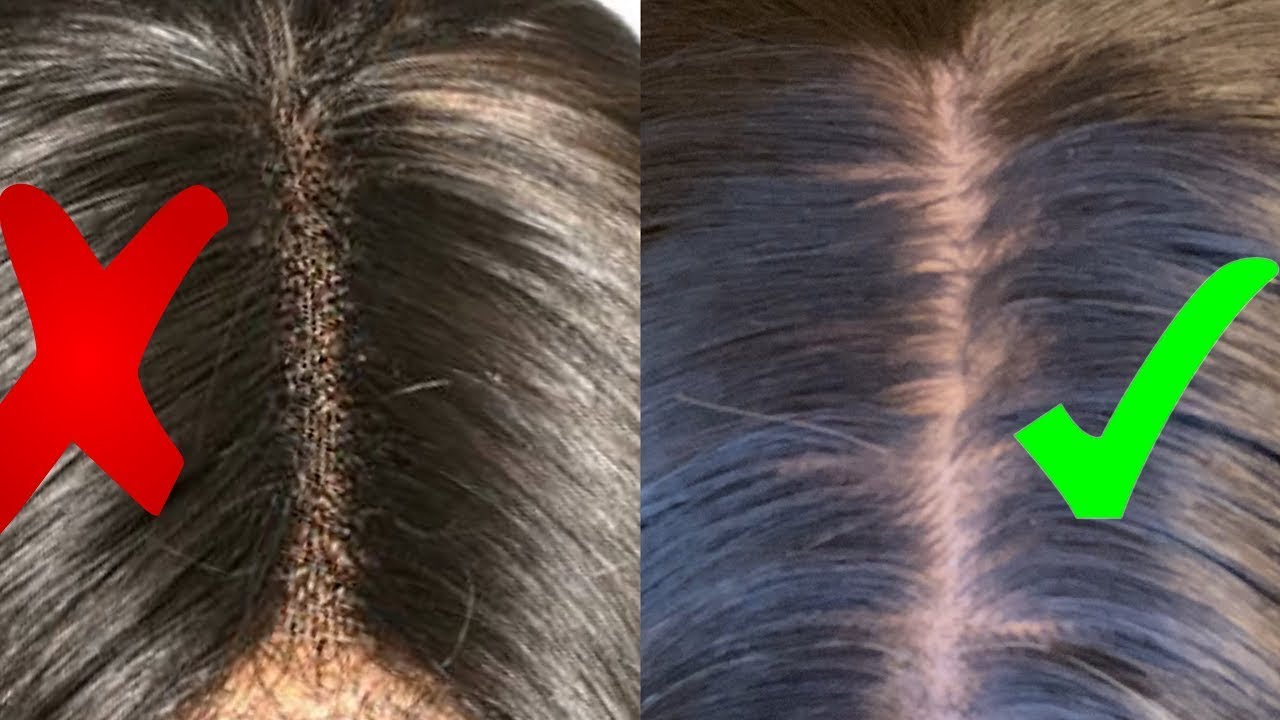 Amazingly realistic Scalp: Nia Pu Skin Wigs!