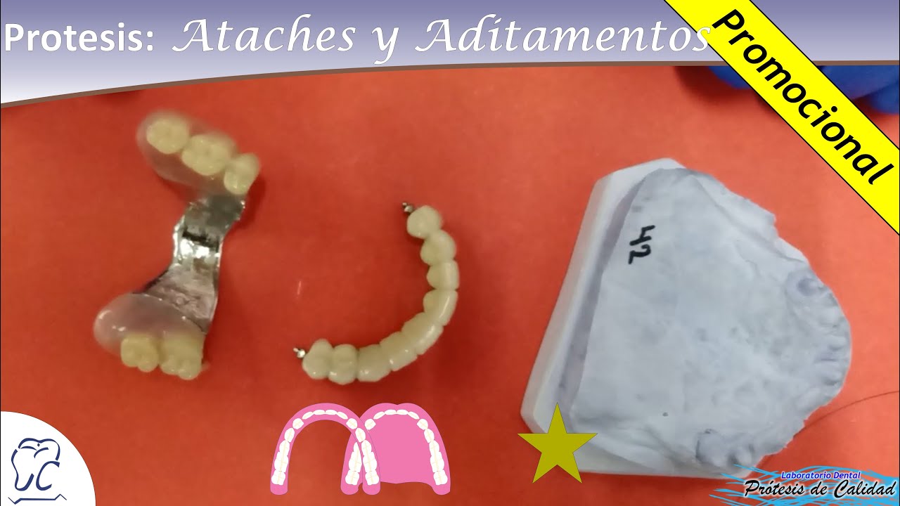 Pr&oacute;tesis: Ataches y Aditamentos 02