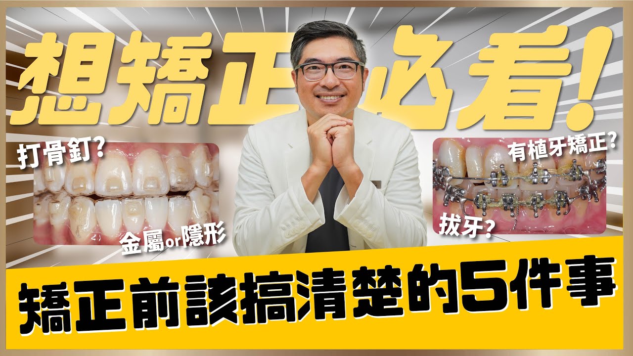 【隱適美矯正 #13】隱適美2025牙齒矯正全攻略🦷🦷牙齒矯正前必看的5件事  ｜【祐民牙醫－隱適美旗艦店】鑽石級楊大為醫師 #隱適美 #矯正 #隱形矯正