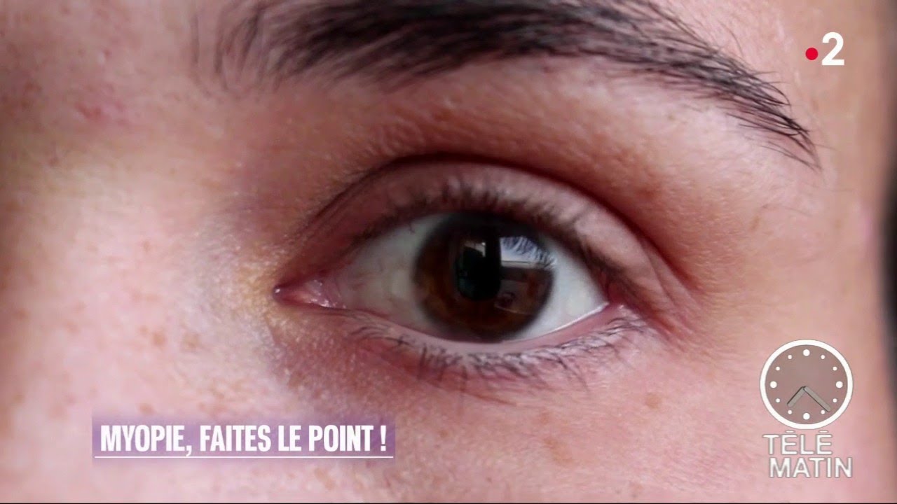 Santé - Myopie - la ralentir, la réduire : le vrai du faux