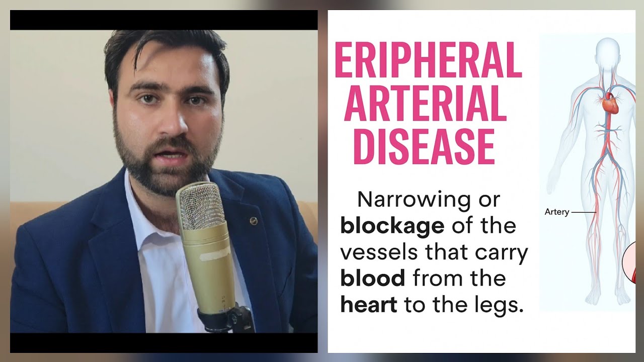 Peripheral Arterial Disease (PAD) | Symptoms, Diagnosis & Treatment Explained