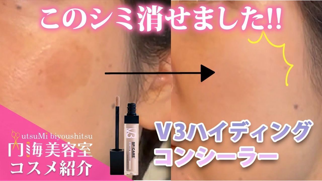 【V3 ハイディングコンシーラ】正しい使い方でシミもばっちりカバー！