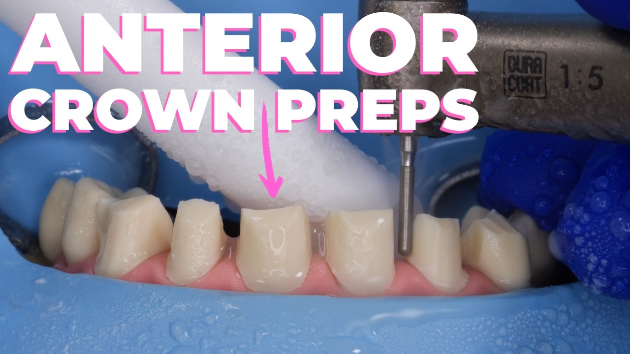 How To: Anterior Crown Preps with Dr. Lincoln Harris