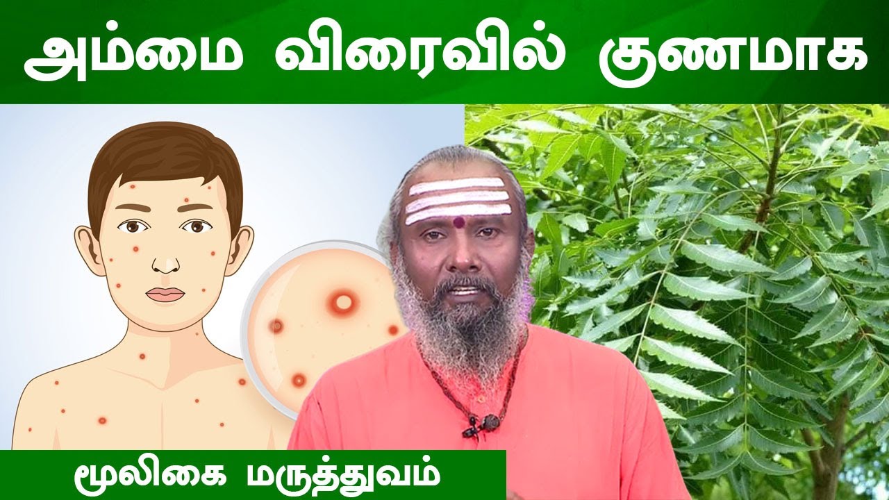 அம்மை விரைவில் குணமாக மூலிகை மருத்துவம் | Chicken Pox | Siddha Medicine | Treatment | Medical