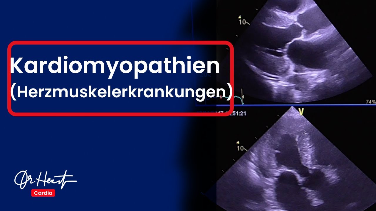 Kardiomyopathie - Was ist das? | Dr. Heart