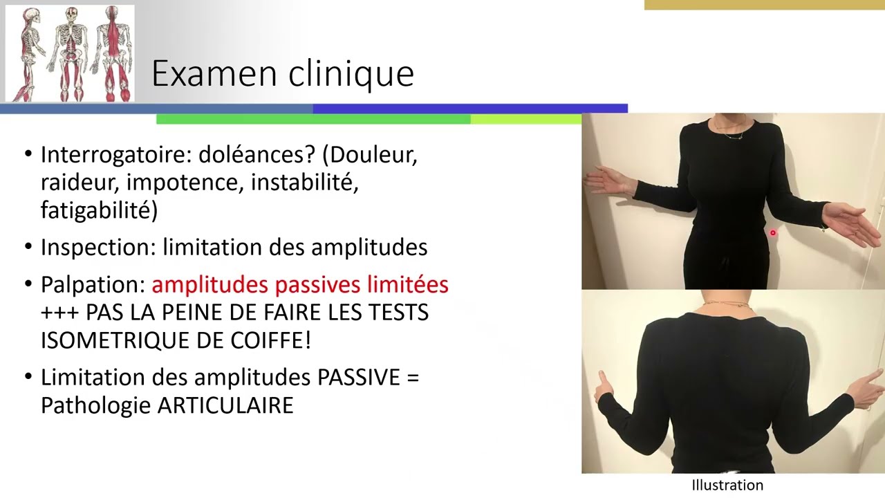 capsulite rétractile: infiltration intra articulaire d'épaule sous guidage échographique.