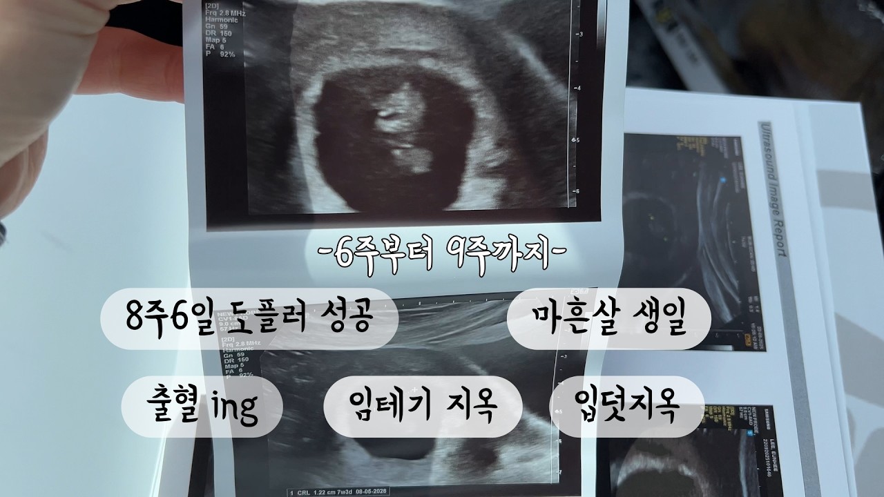 6주부터 9주까지, 마흔살 생일, 8주차에 도플러 성공, 입덧지옥, 출혈은 계속되고...