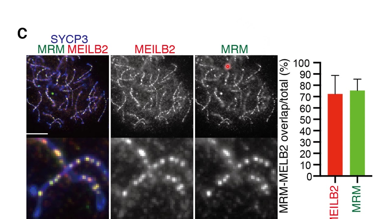 MRM/4930432K21Rik modulates localization of RAD51 and DMC1 to DSBs in meiotic recombination