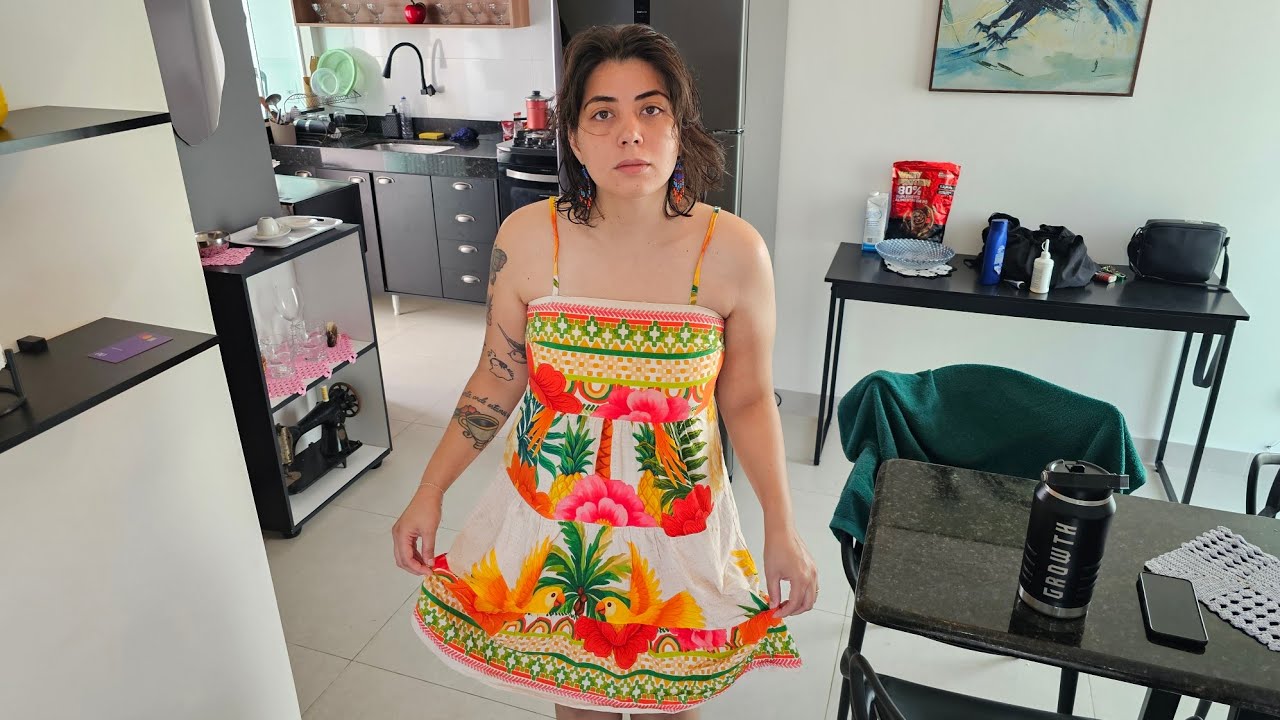 Minhas pernas após a queimadura ficaram assim