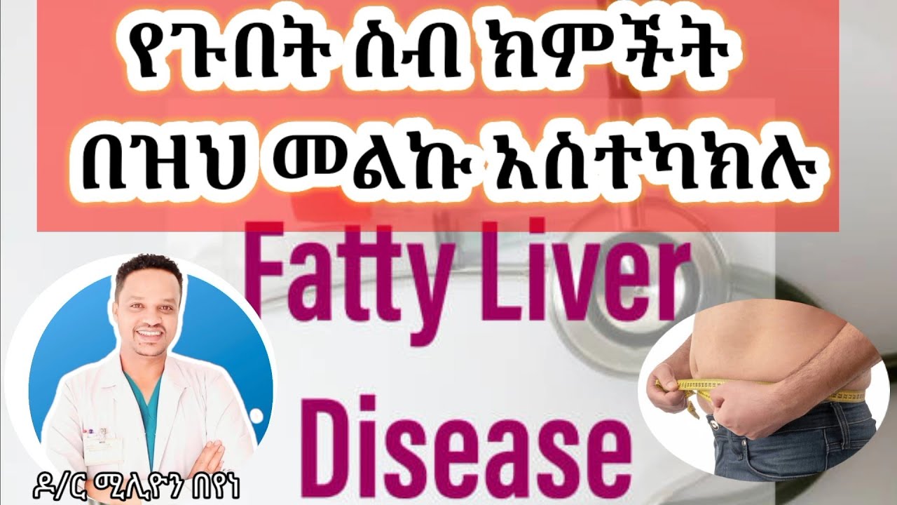 Fatty liver /የጉበት ስብ/ ያለባችሁ ያለመድሀኒት በዝህ መልኩ መመለስ/Reverse / አድርጉ