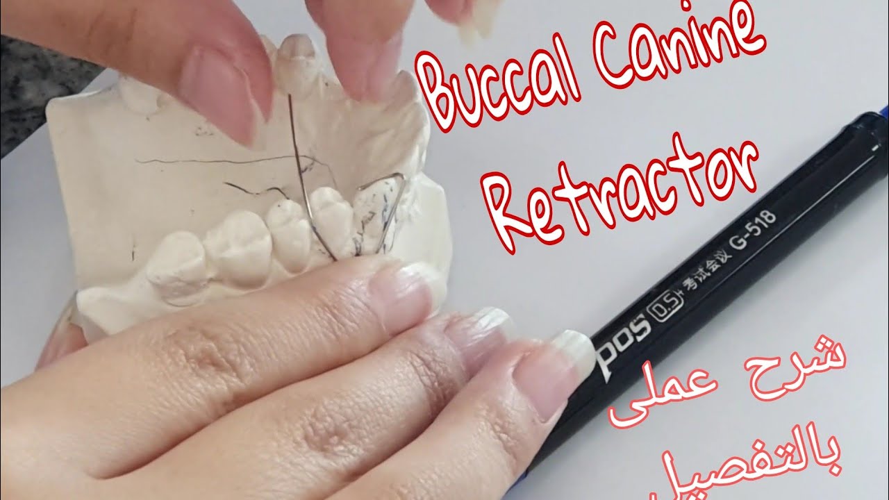 Buccal Canine Retractor |Orthodontic lab || شرح عملى بالتفصيل