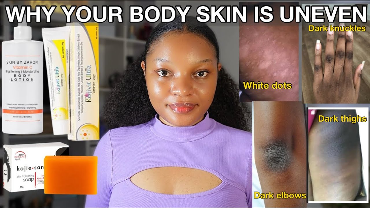 How to Fix Uneven Skin Tone on the Body: Dark Spots, White dots & Texture | Head to toe Results ✅