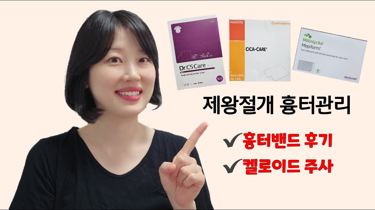 제왕절개 흉터관리/ 켈로이드 주사후기(흉터사진有)/ 흉터밴드 후기