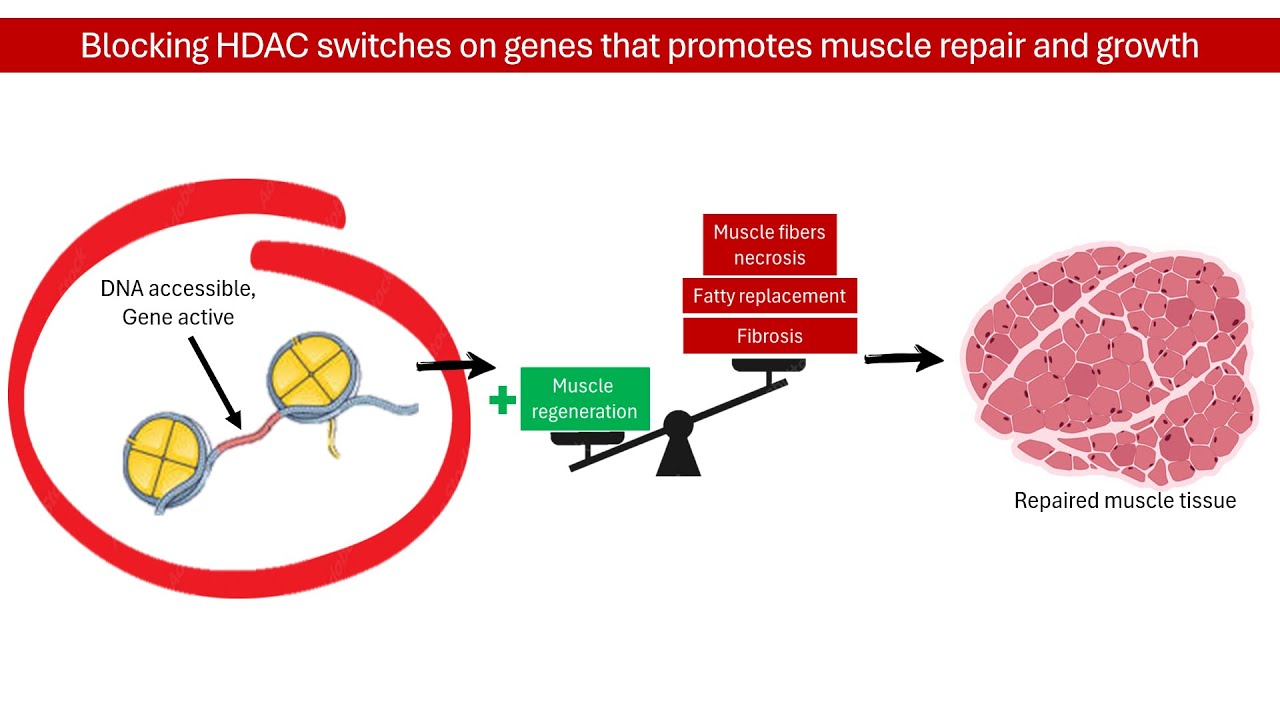 Duchenne Muscular Dystrophy (DMD) Hope: New Treatment - Givinostat Explained! │PHARMACOLOGY