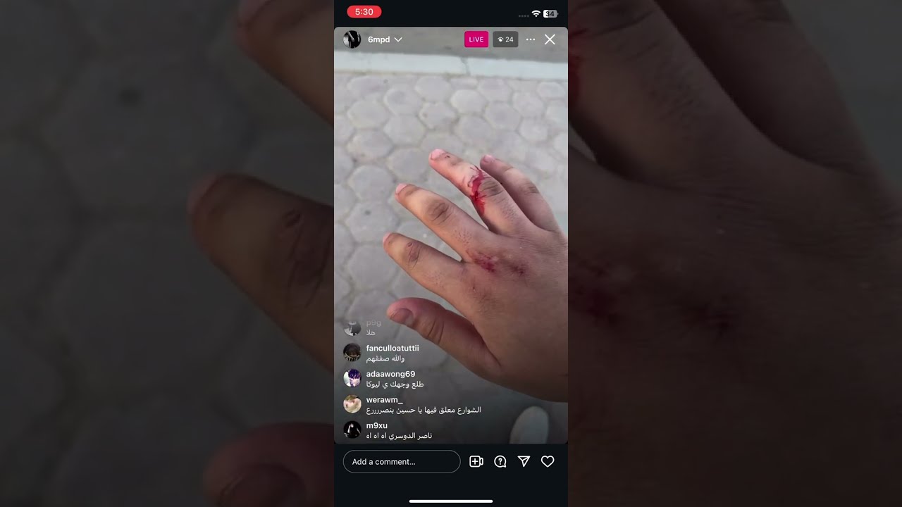 مضاربه وهوشة بث مباشر قوية دسكورد - فري مايك