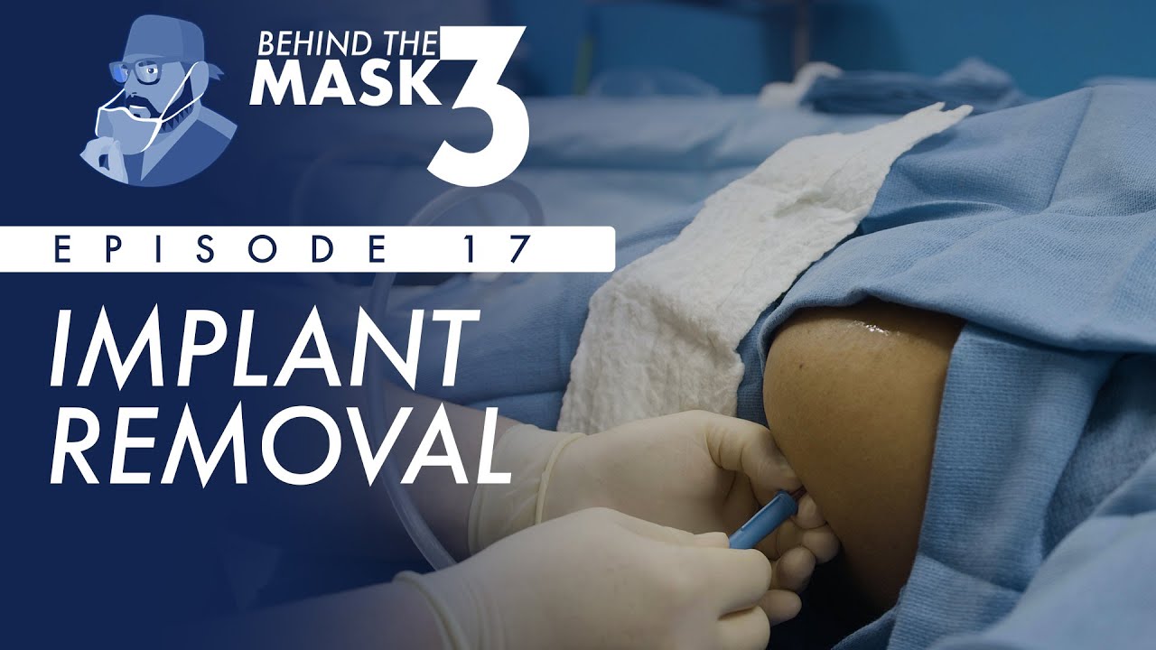 Breast Implant Removal and Breast Lift
