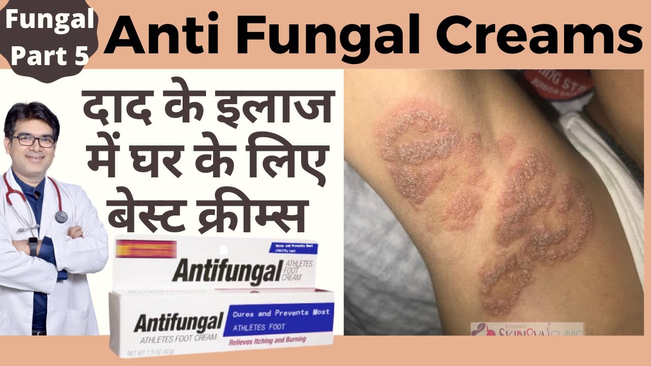 दाद की क्रीम | Best AntiFungal Creams | Best Fungal Infection Creams | Dermatologist | Dr Sunil