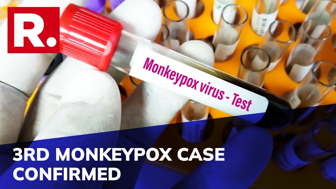 Monkeypox: Third Case Of Virus Confirmed In Kerala; Patient Currently Undergoing Treatment