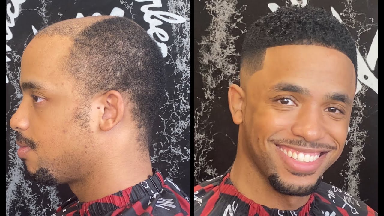 He literally looks 10yrs younger ❤️ hairunit transformation
