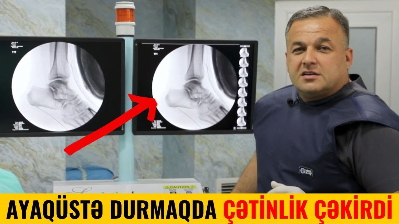 Daban Ağrısı olanlar M&Uuml;TLƏQ İZLƏYİN!