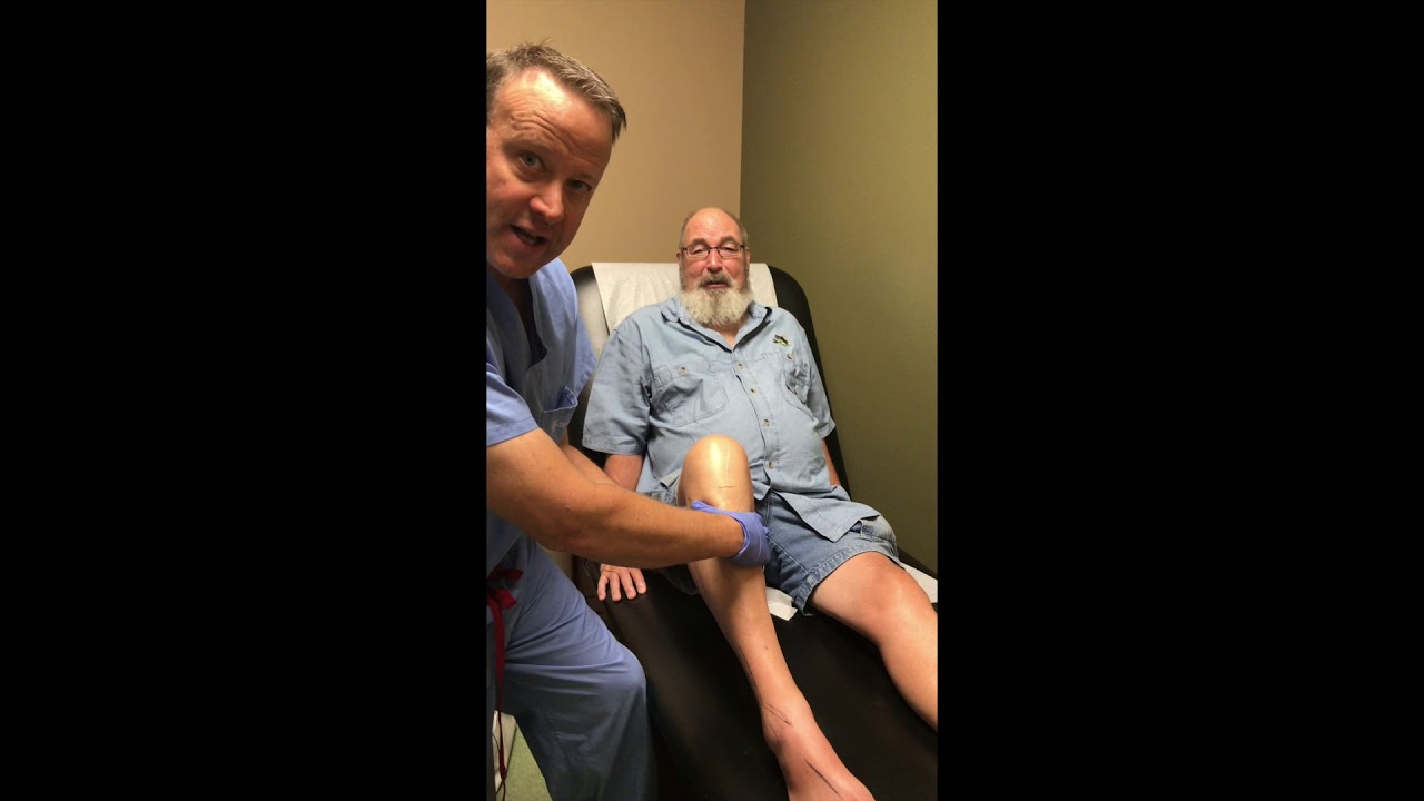 Nerve Entrapment Exam ( CECS crossover )