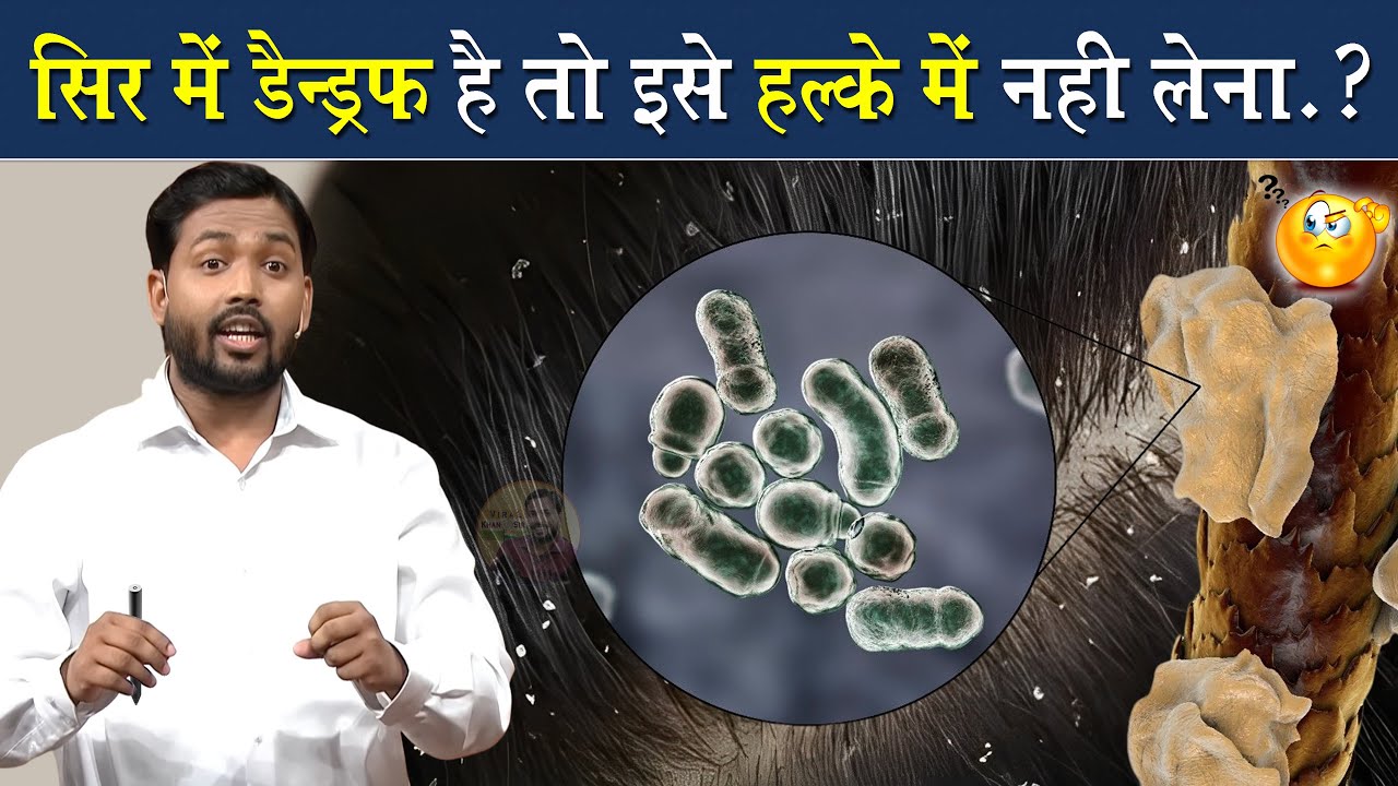 सर में है रूसी तो तुरंत करे ये काम || Viral Khan Sir