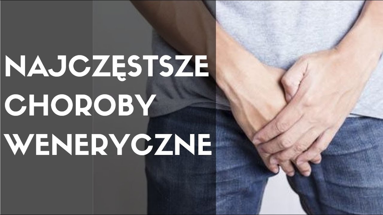 Dermatolog mówi o: CHOROBY WENERYCZNE