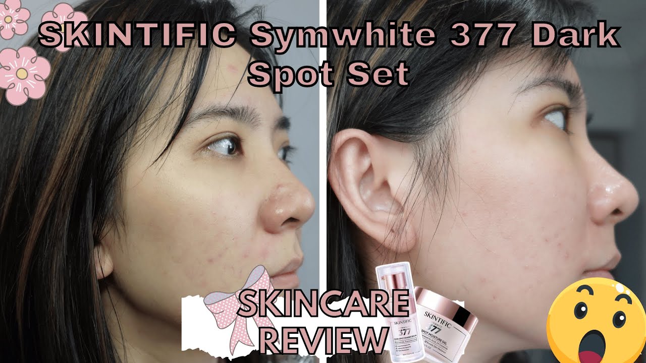 Обзор сыворотки и увлажняющего средства от темных пятен SKINTIFIC Symwhite 377 2024