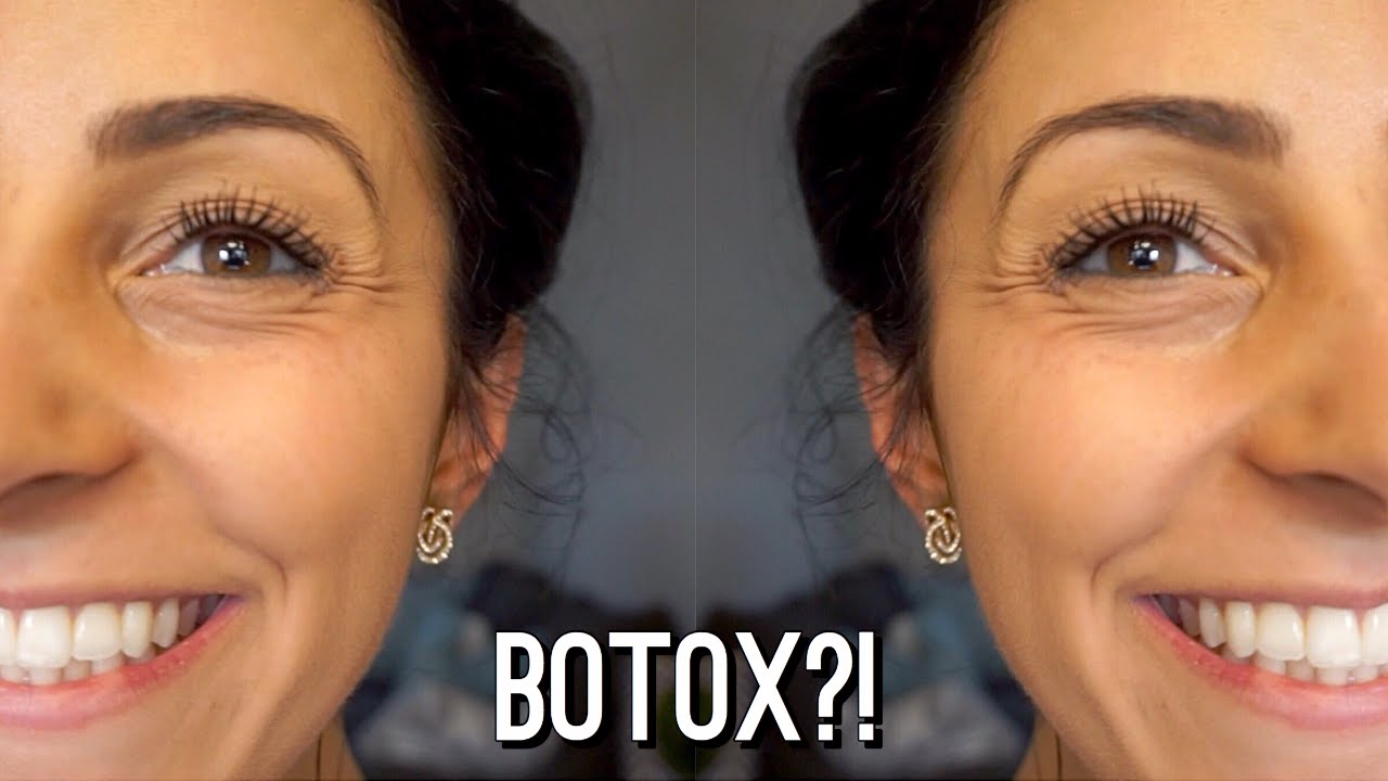 Sodium, Water, and Botox?! | 3 Days Out Ep. 67