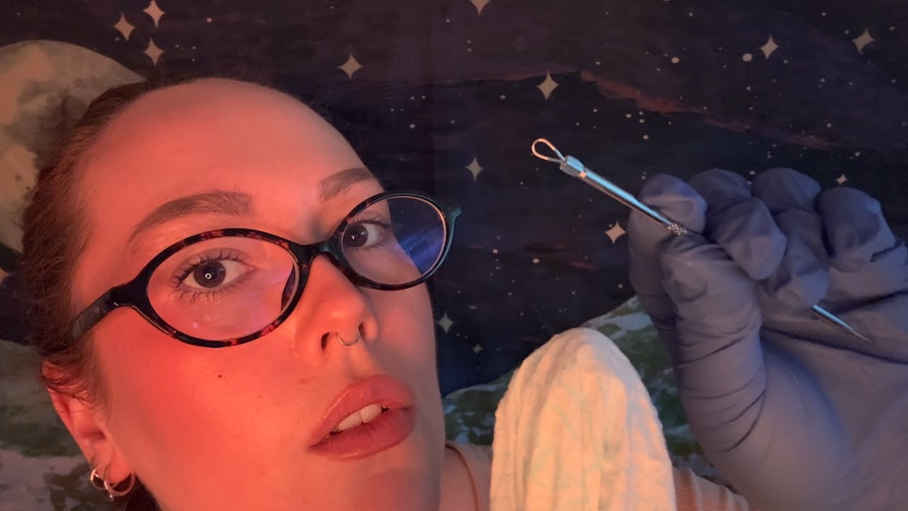 ASMR | First Person POV Blackhead & Pimple Extraction On & In Your Ears - Gloves, Soft Spoken