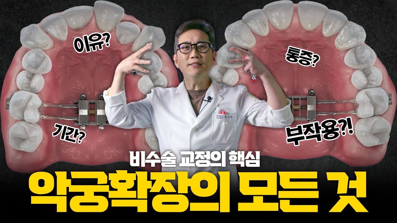 당신의 위턱을 넓혀야 하는 이유