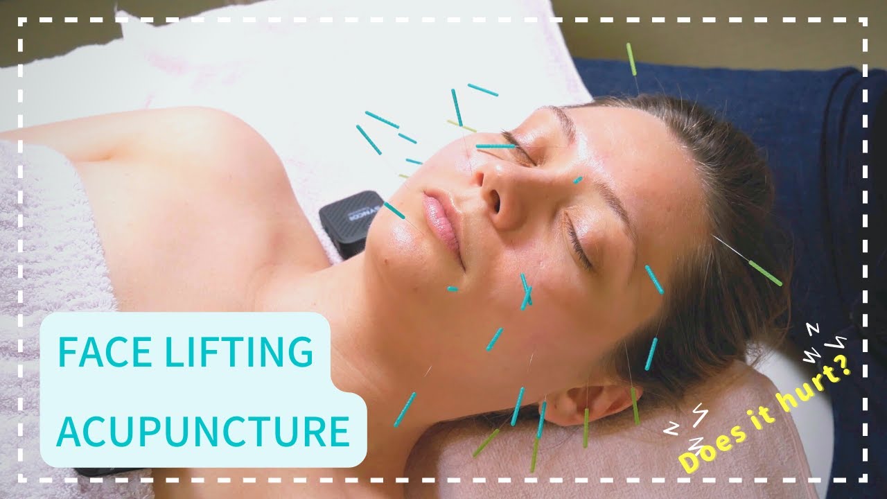[ASMR] Facial ACUPUNCTURE - Beauty acupuncture and massage- 美容はりトリートメントとフェイシャルマッサージ