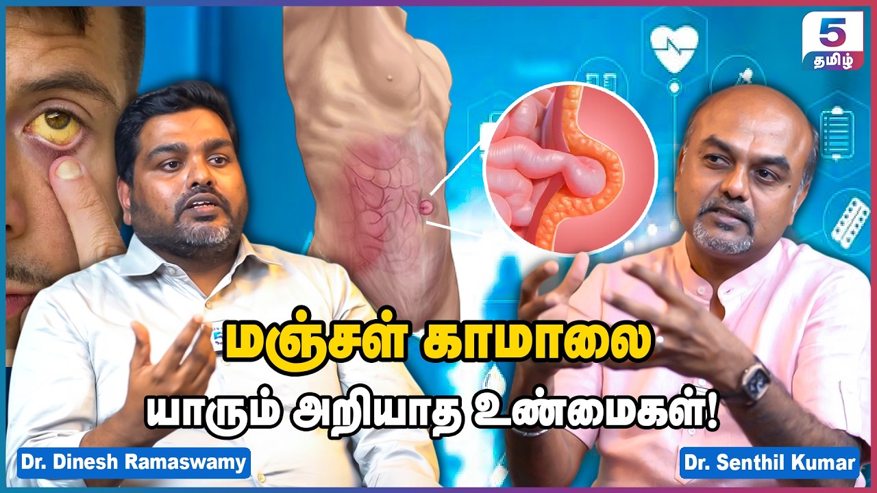 மஞ்சள் காமாலையை அலட்சியமா விடாதீங்க! Dr Senthil Kumar & Dr Dinesh Ramasamy Interview