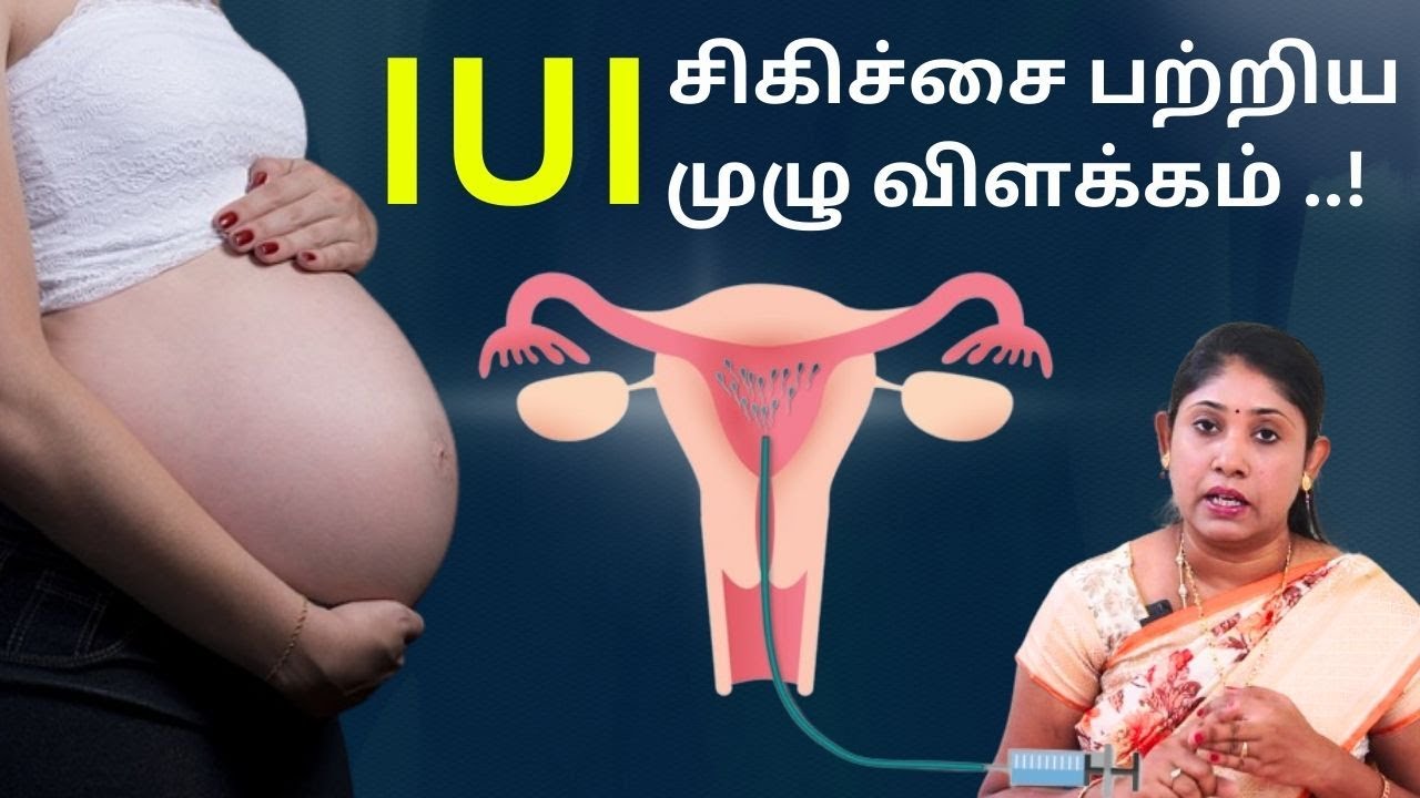 IUI   சிகிச்சை பற்றிய முழு விளக்கம் ..!