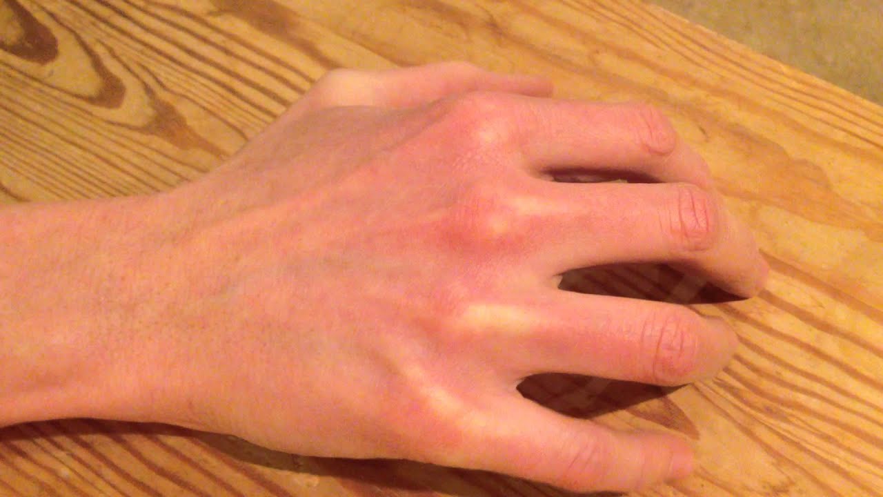 Handträning 2. Handryggs spridning