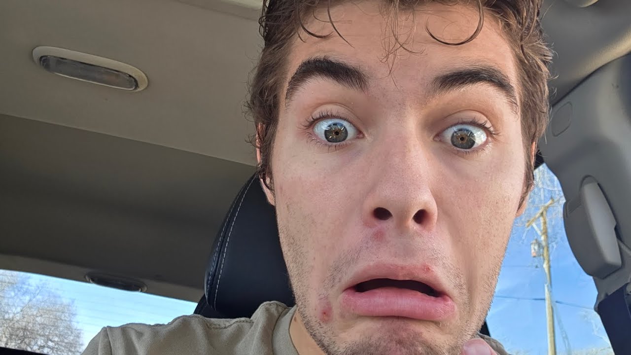 ZITS SUCK
