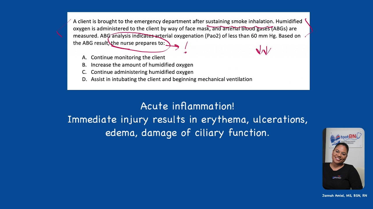 NCLEX Practice Item: Smoke Inhalation Injury